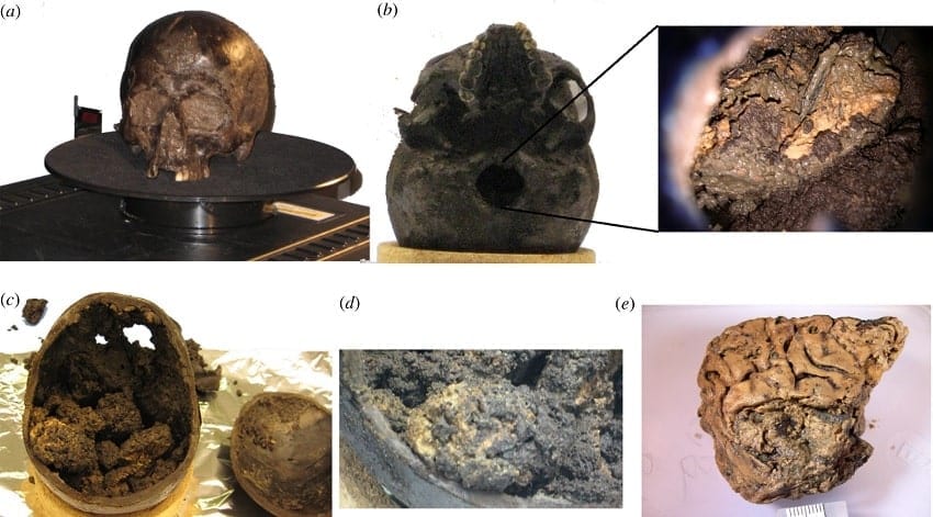 La pr servation d un cerveau  intact vieux  de 2500 ans 